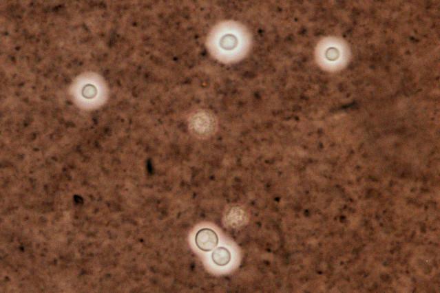Como fazer exames de testes para infecções fúngicas em casa?