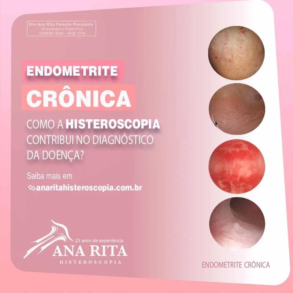 O que é endometrite e seus principais sintomas